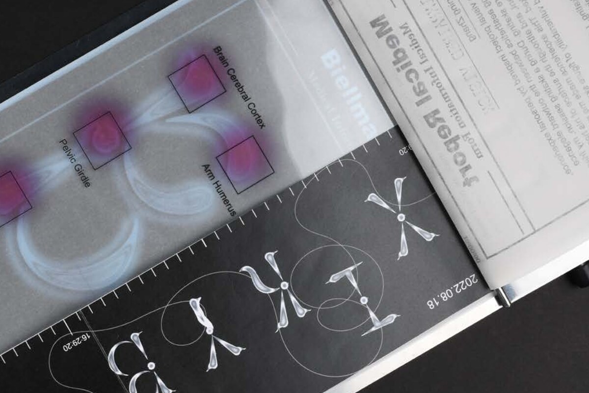 A semi-transparent printed sheet over a dark typographic page, held in an aluminium clipboard, with pink marks locating injuries on a body diagram